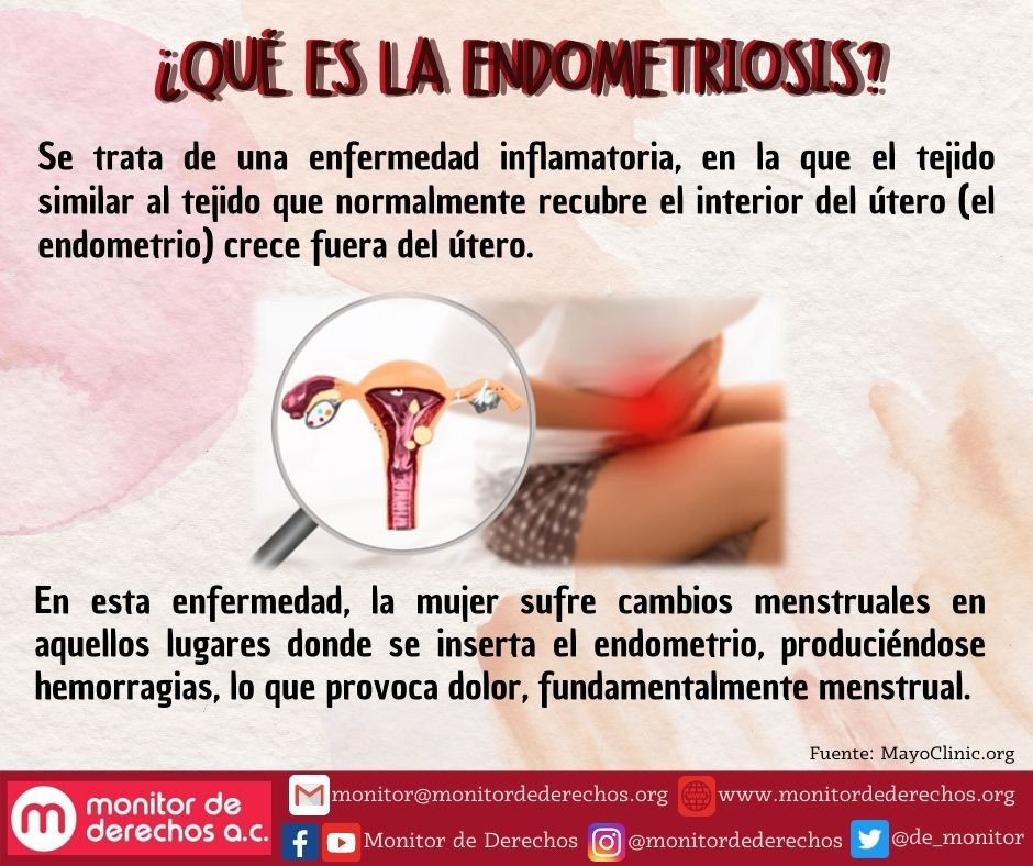 ENDOMETRIOSIS